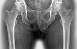 Gövde ve Alt Ekstremite Cerrahisi