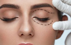 Göz Kapağı Estetiği